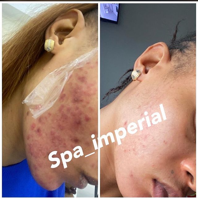SKIN CARE WITH SPA IMPERIAL