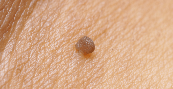 Skin TAg