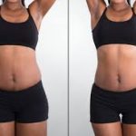 Body Fat Reduction
