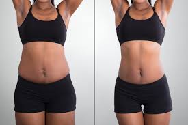 Body Fat Reduction